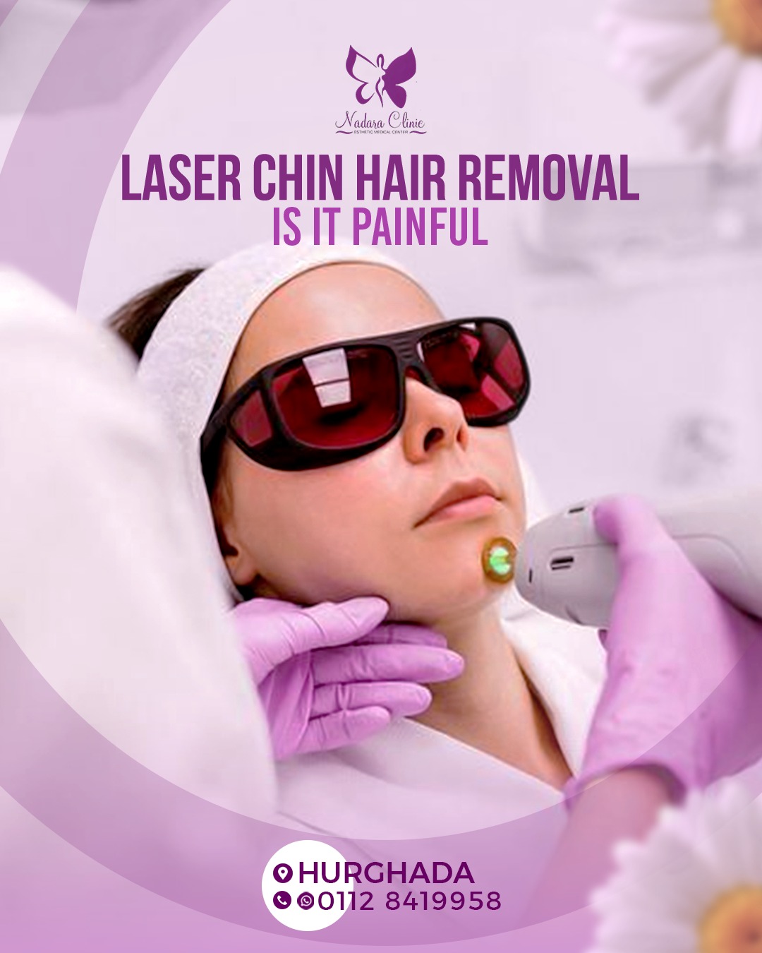 Laser beard hair removal in Hurghada